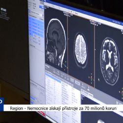 Region: Nemocnice získají přístroje za 70 milionů (TV Západ)